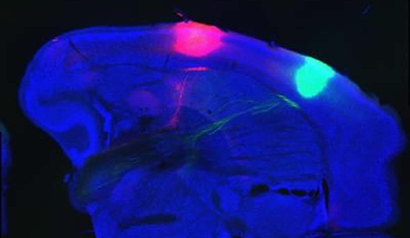 Image shows the areas of the brain which control bitter and sweet tastes in the mouse brain.