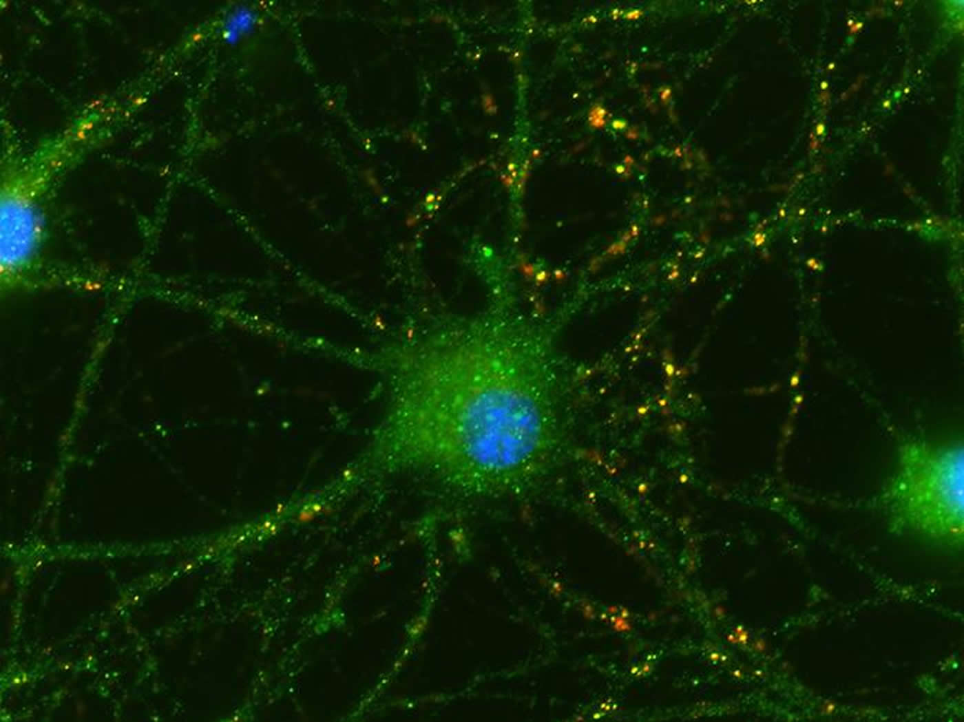 Image shows neurons.