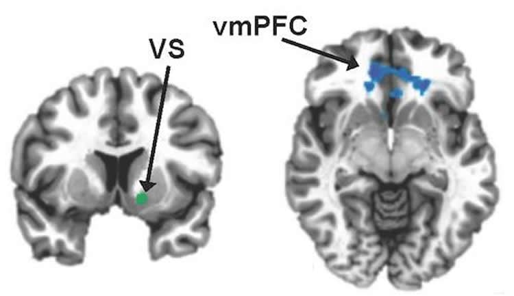 ventrolateral prefrontal cortex