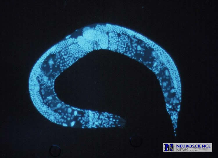 Photo of a C.elegans.
