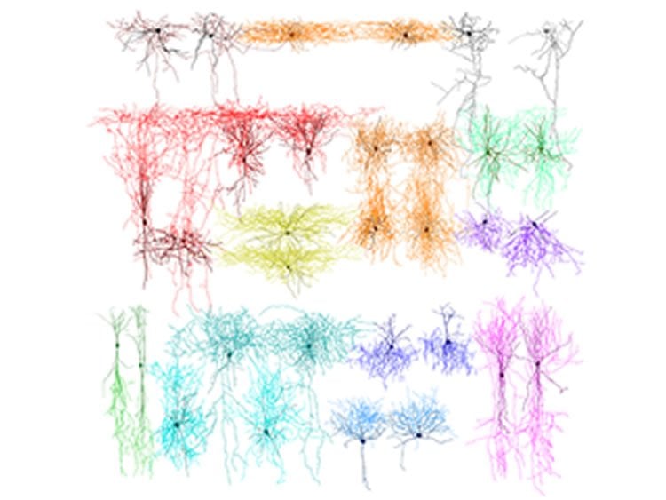 Image shows axons and dendrites of different neurons.