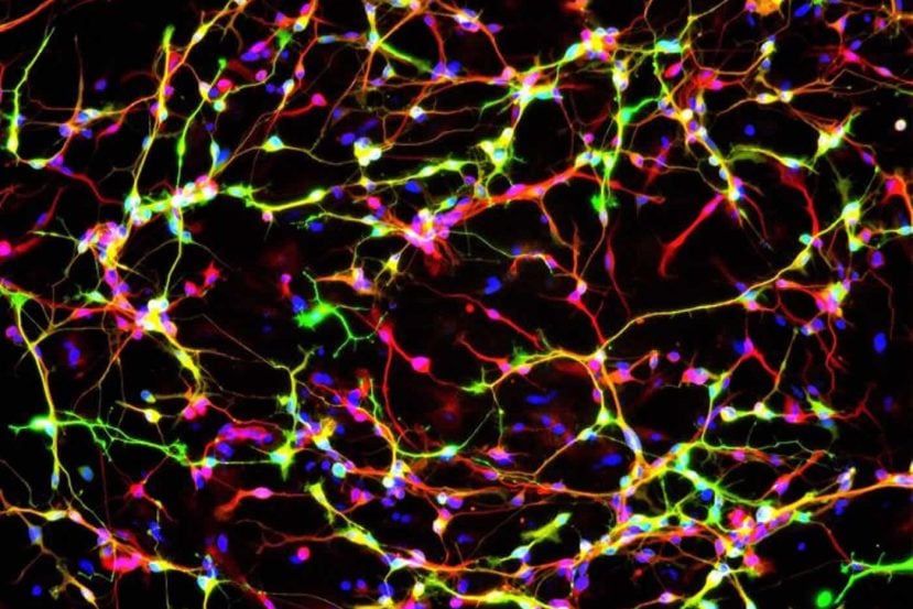 Image shows dopamine neurons.