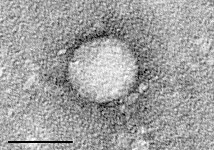 Image shows hep C virus purified from cell culture.