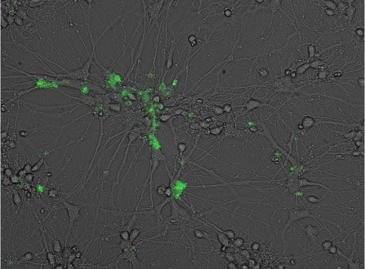 Image shows a neuron at 5 days post infection with EBV.