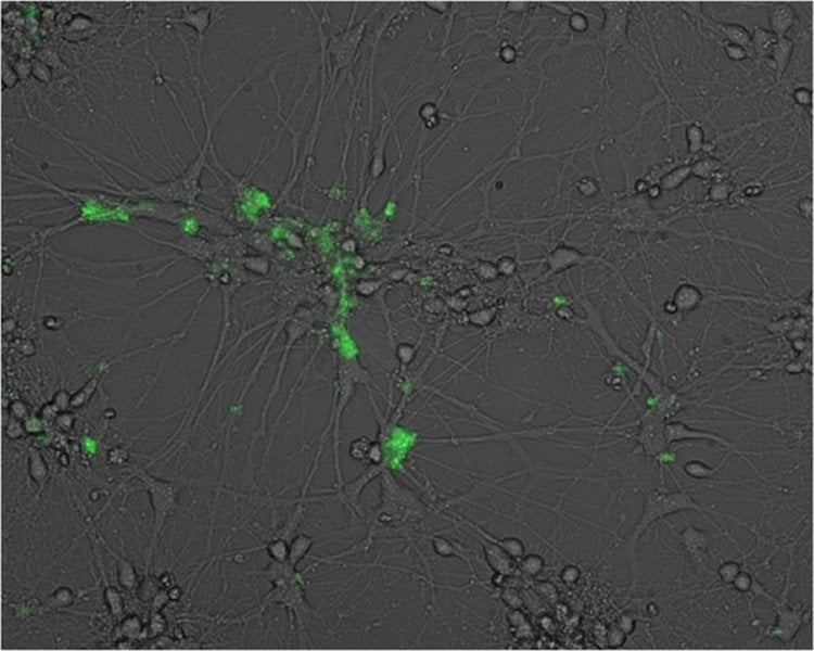 Image shows a neuron at 5 days post infection with EBV.