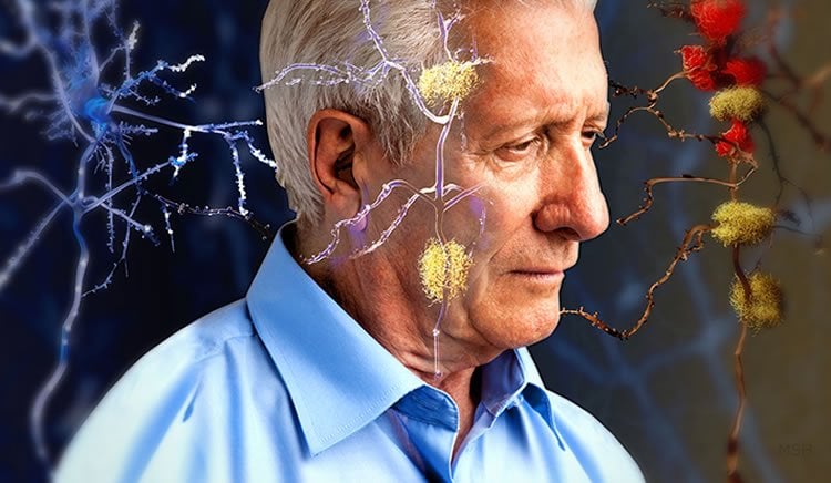 Photo of an older man and neurons.