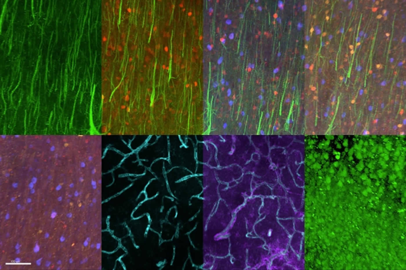 Image shows different brain tissue samples.