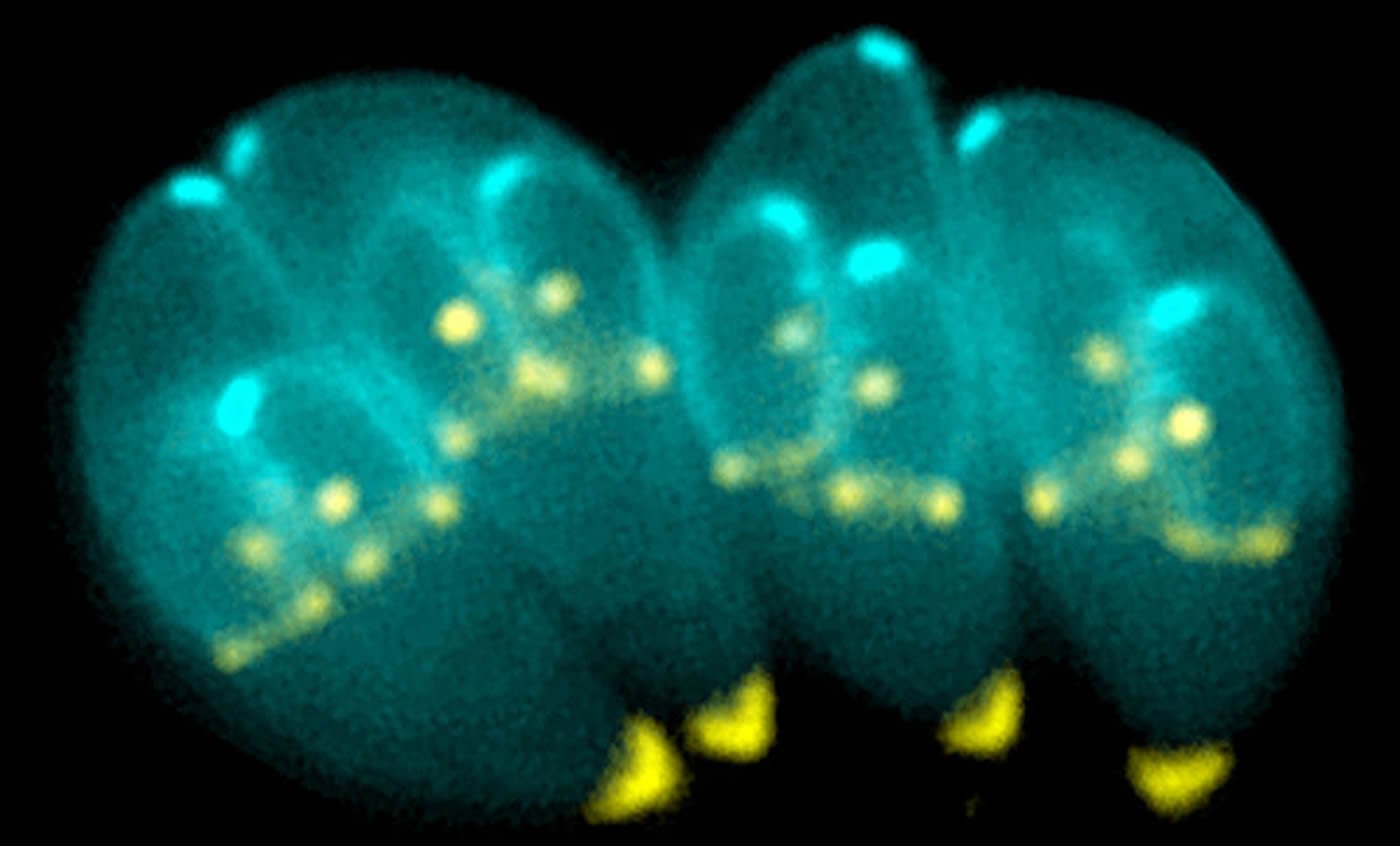 Image shows dividing T. gondii parasites.