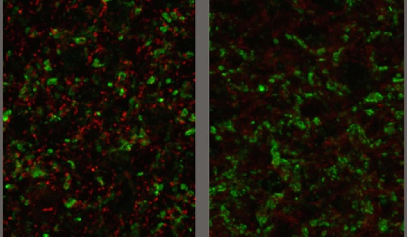 Image demonstrates how a Toxoplasma infection alters the inhibitory nerve terminals.