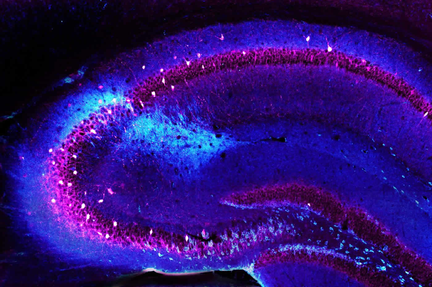 Image shows inhibitory neurons in the CA2 region of the hippocampus.