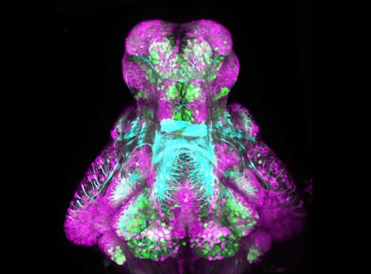 Image shows ventral view of a larval wild-type zebrafish brain.