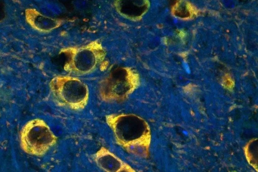 Image shows dopaminergic neurons.