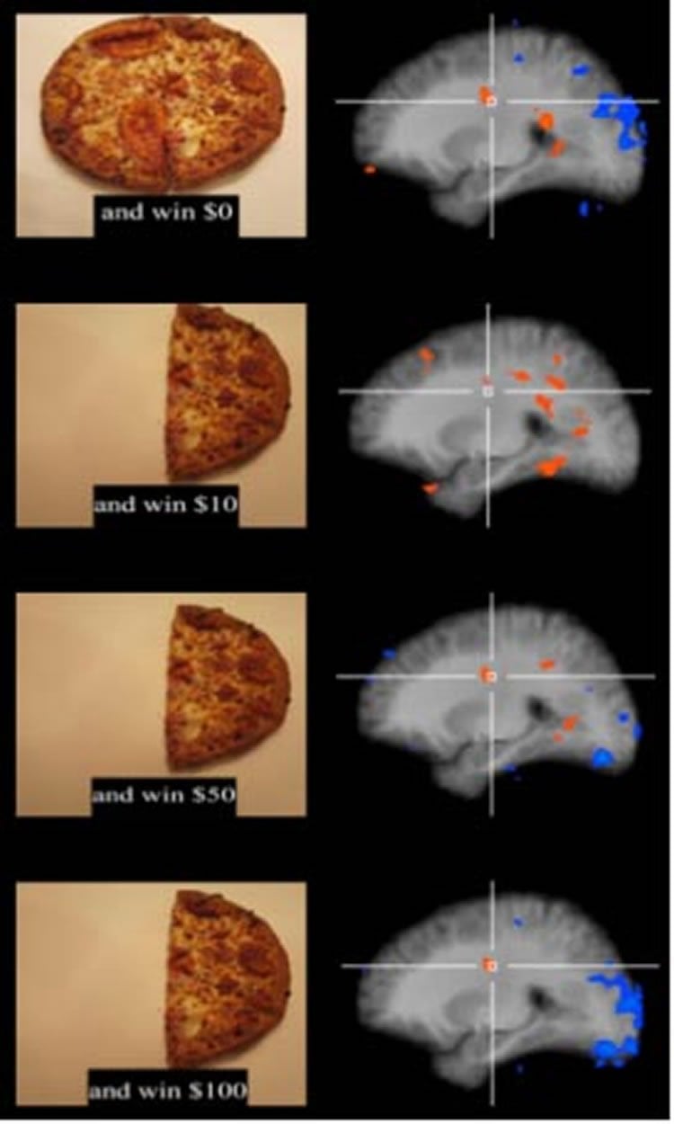 Image shows brain scans from the study.