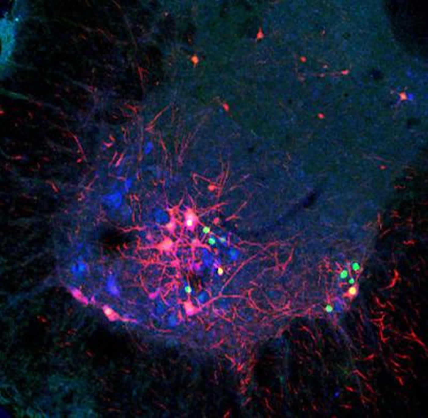 Image shows star motor neurons.
