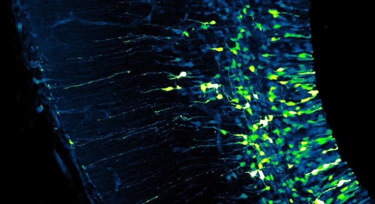 Image shows a neural stem cells and neurons.