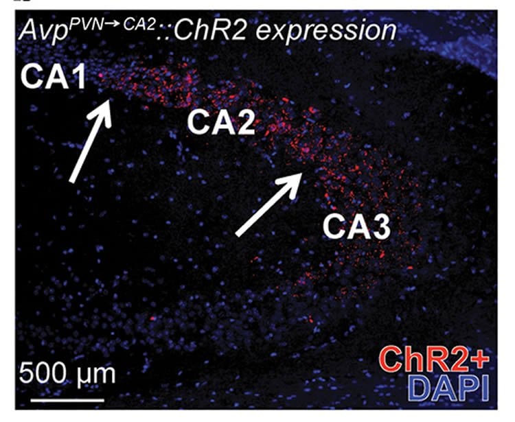 The image shows the CA1 and CA2 regions of the hippocampus.