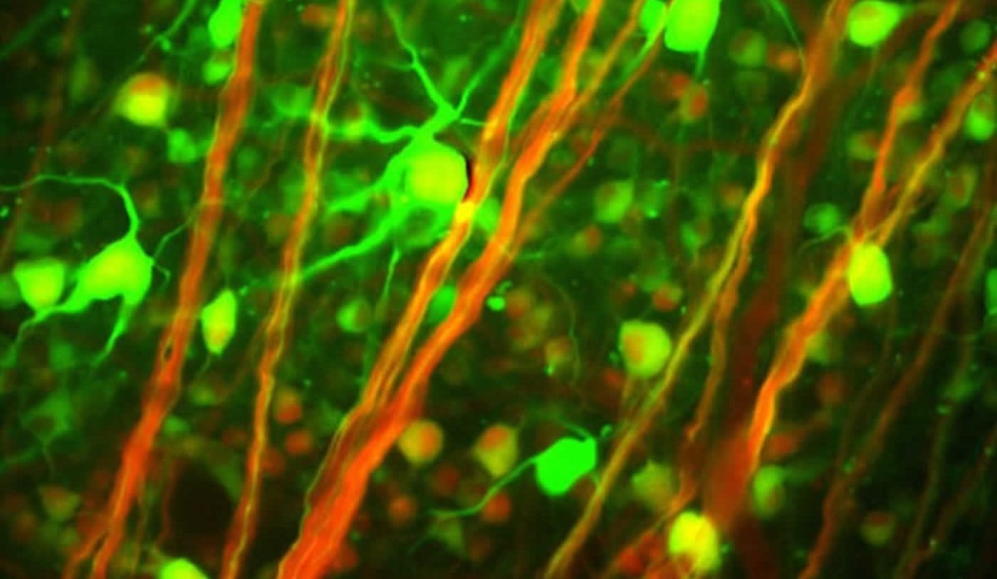 Image shows neurons.