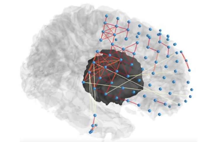 Image shows brain with a network overlayed.