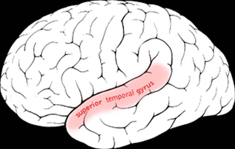 Image shows the location of the superior temporal gyrus in the brain.