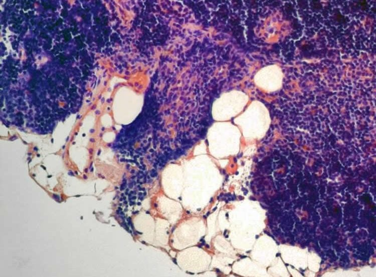 Image shows fatty cells in the aging thymus.