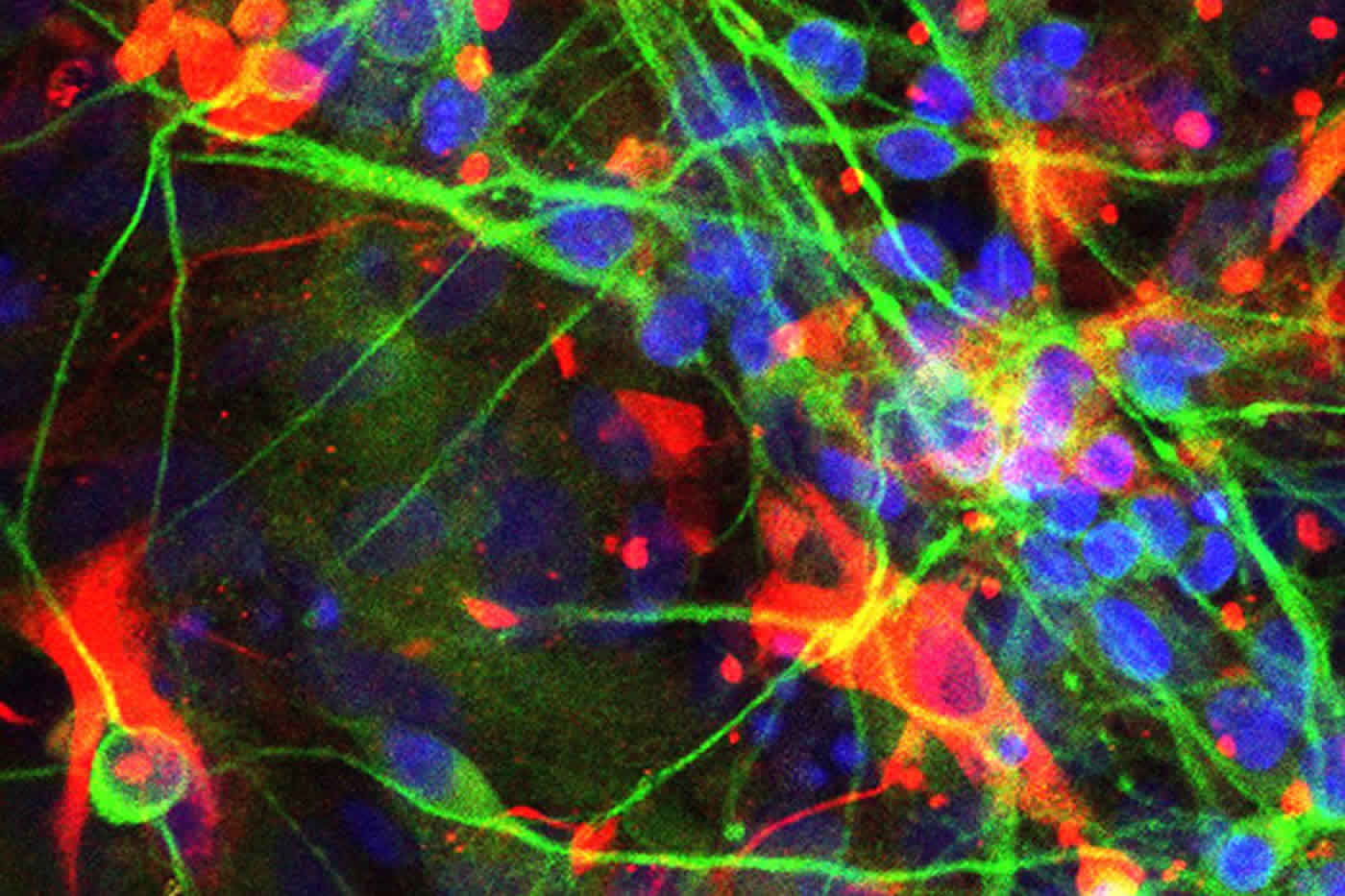 Image shows neurons and astrocytes.