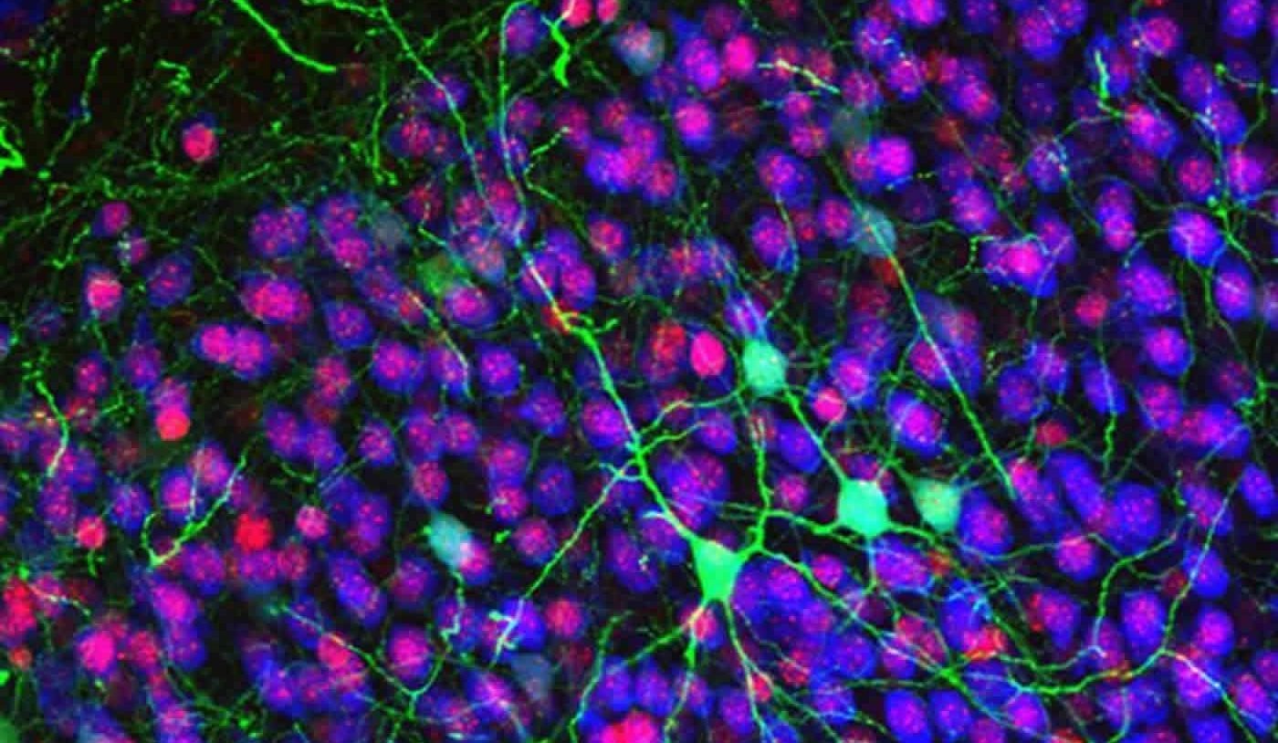 Image shows callosal projected neurons in the cerebral cortex.