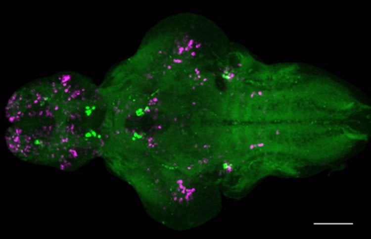 Image shows a larval zebrafish brain following overexpression of Nmu.