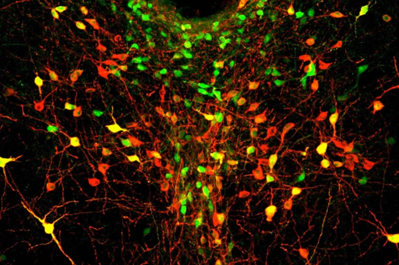 Illustration of a DRN dopamine neuron.