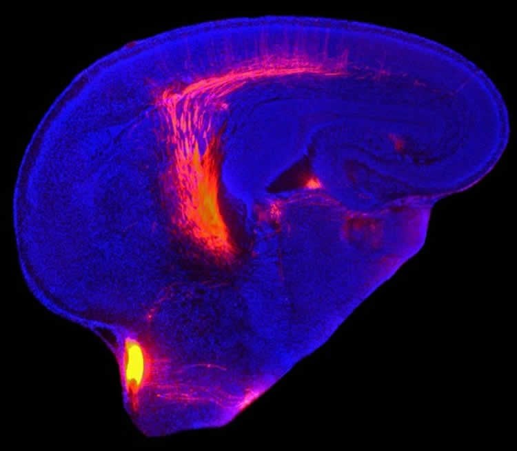 Image shows the forebrain. The caption best describes the image.