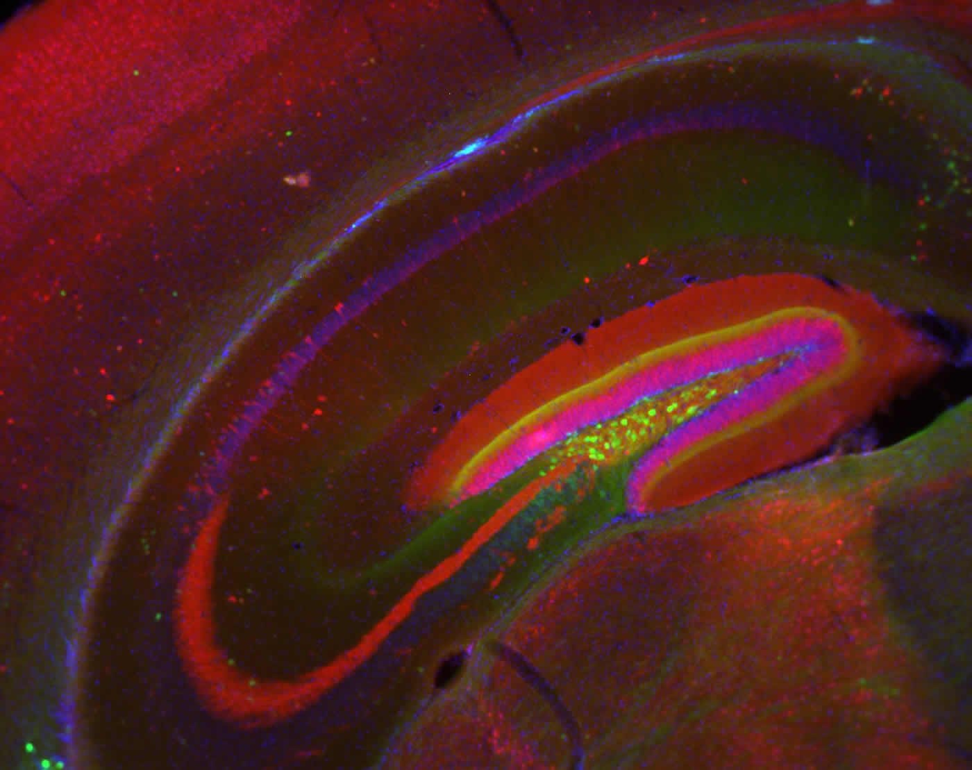 Image shows a stained mouse hippocampus.