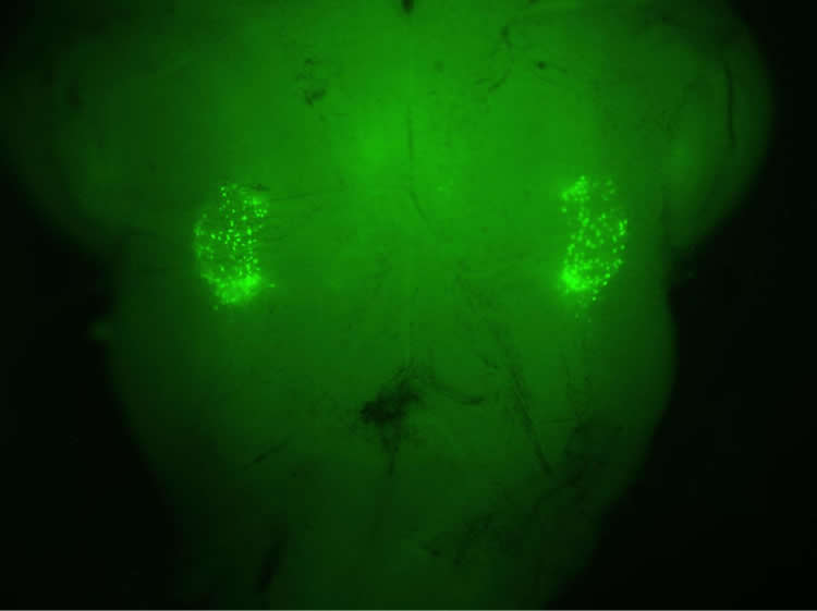Image shows sigh reflex neurons.