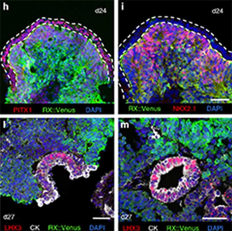 Image shows the pituitary gland.