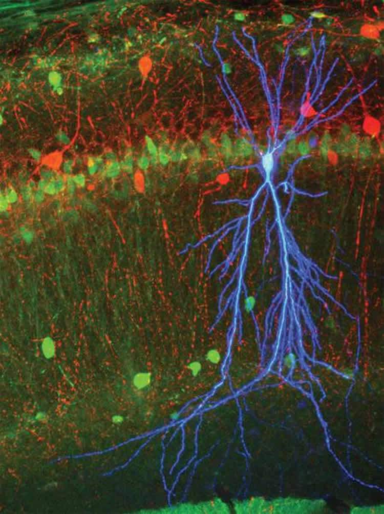 This image shows a stained pyramidal cell.