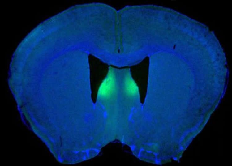 Image of the lateral septum in a mouse brain.