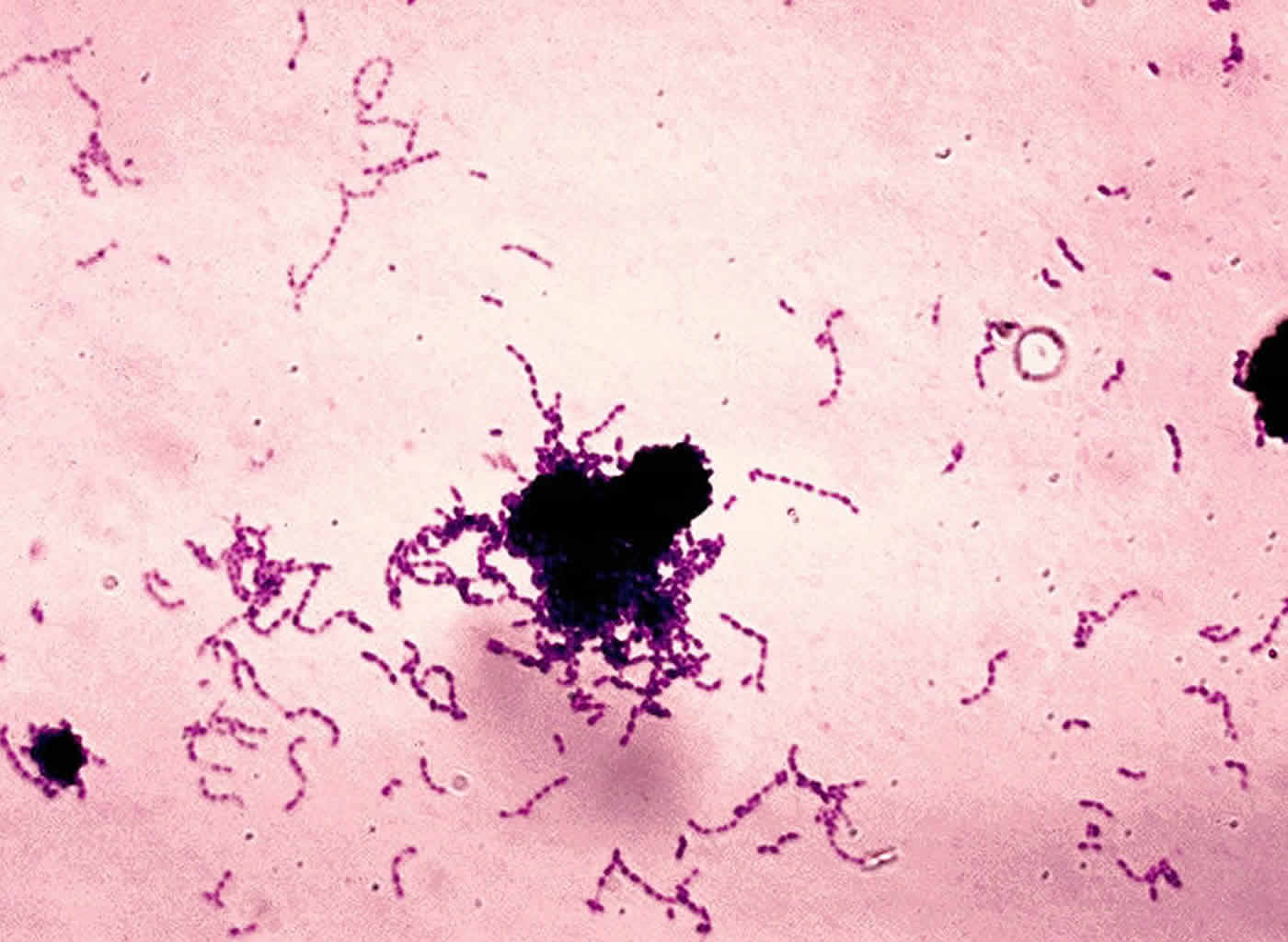 Image shows Streptococcus mutans.