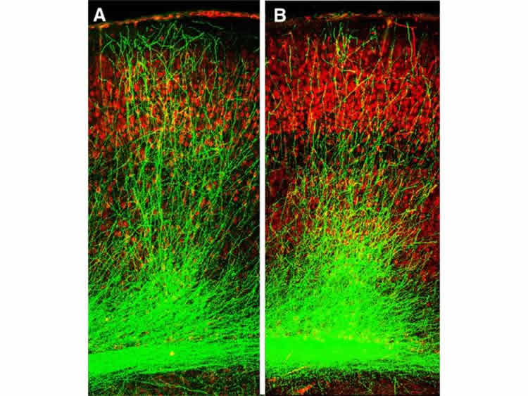 This image shows the stunted growth of neuronal branches.