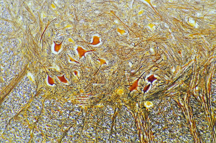Image shows spinal cord neurons.