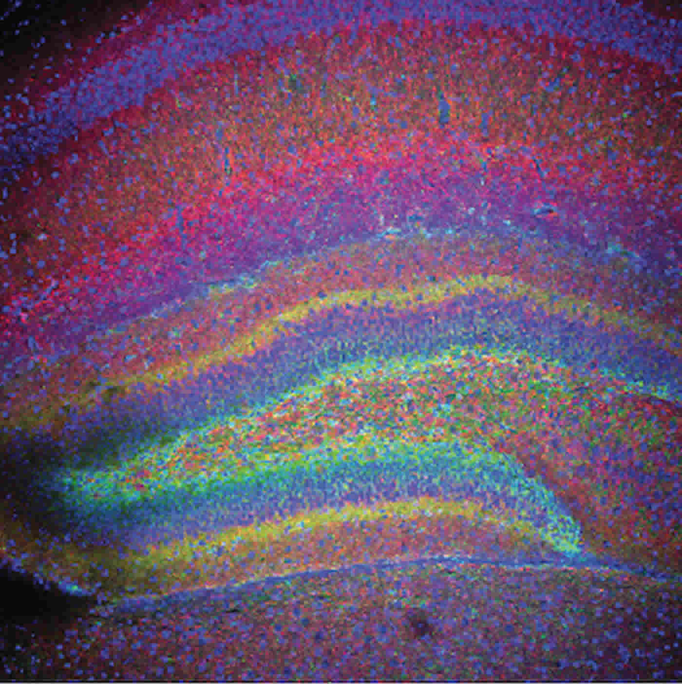 Image shows a stained hippocampus slice.