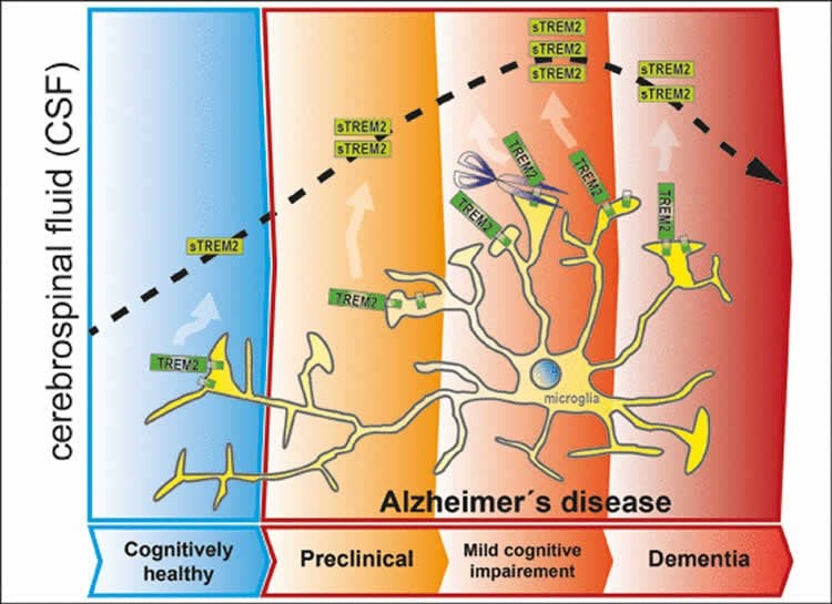 Diagram shows how TREM2 attaches to neurons.