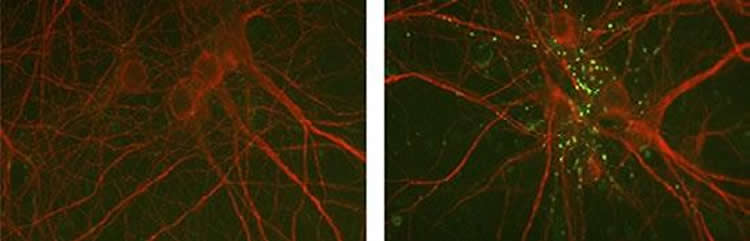 Image shows cortical neurons.