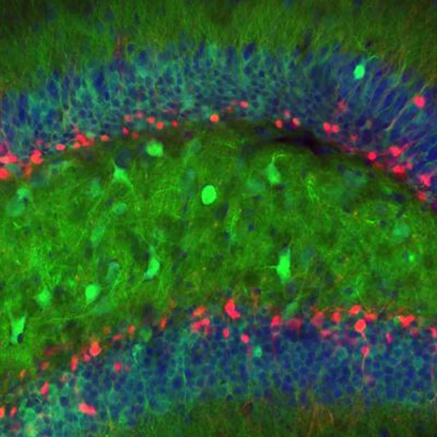 Image shows granuel cells in a mouse dentate gyrus.