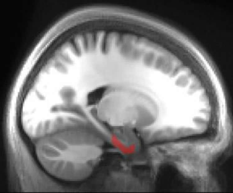 Image shows a brain scan with the entorhinal cortex highlighted in red.