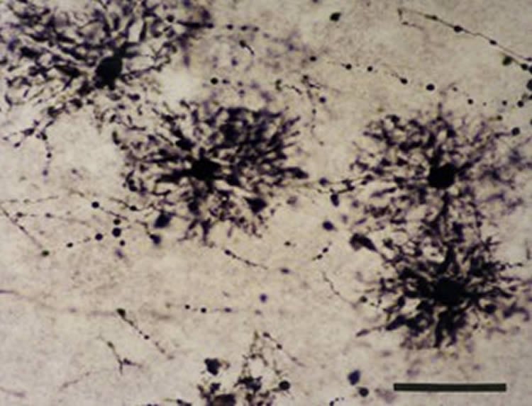 Image shows astrocytes in the hippocampus.