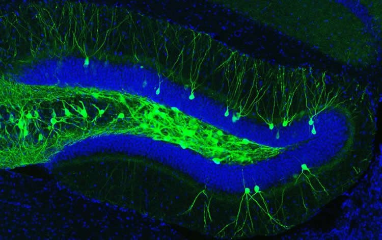 Image shows hippocampal cells.