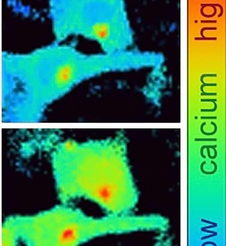 Image shows skin cells.