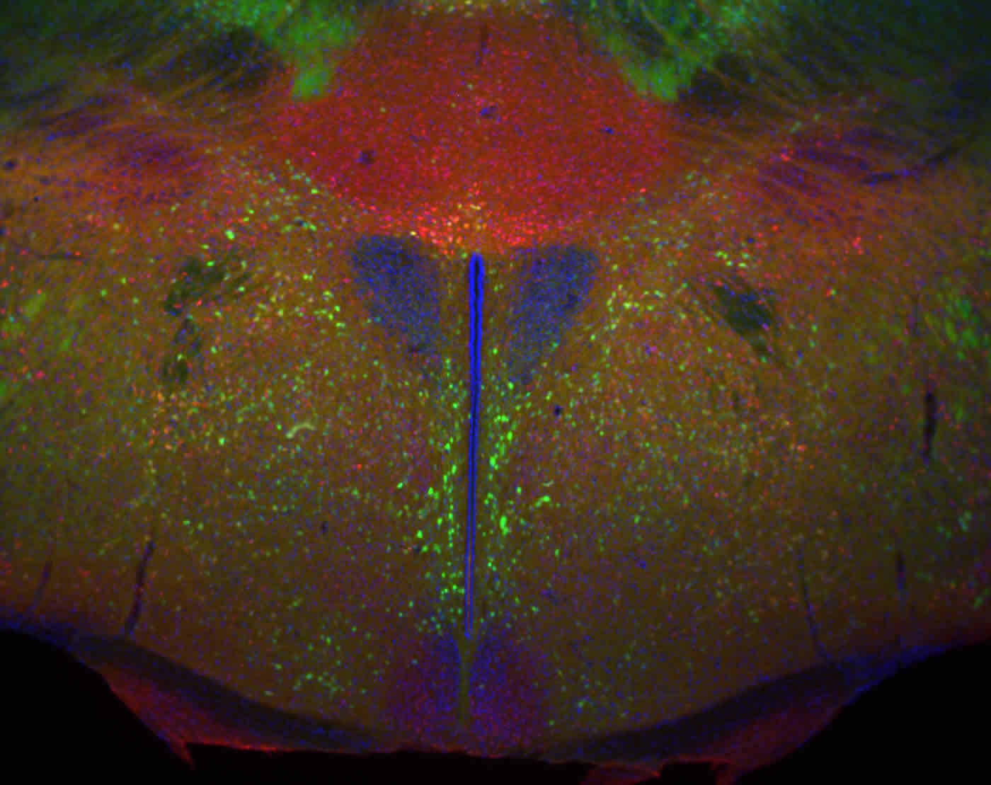 Image shows a stained mouse hypothalamus.