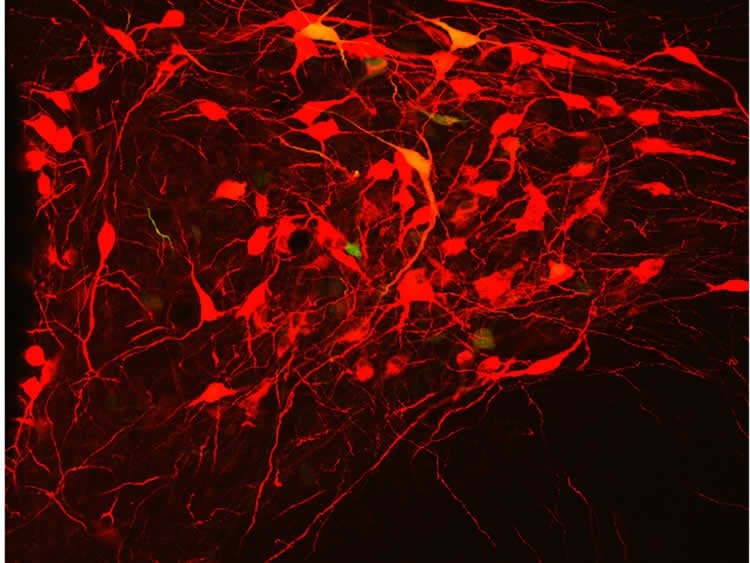 Image shows oxytocin producing neurons.