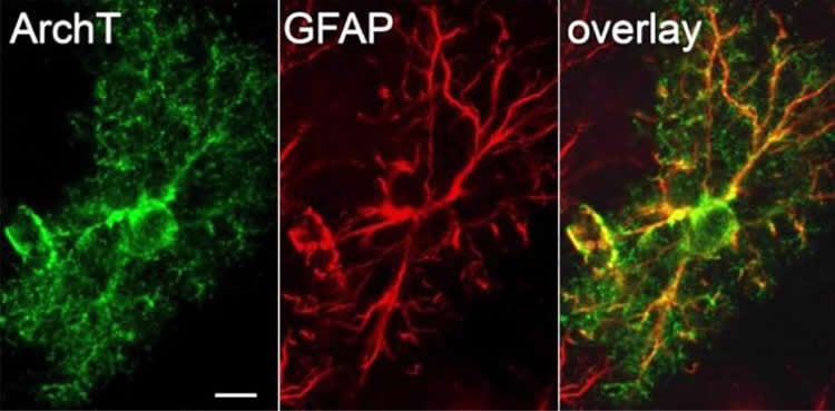 Image shows astrocytes.