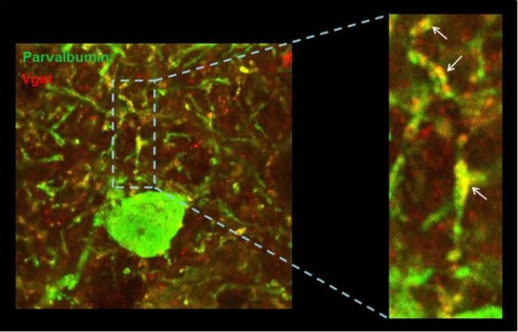 Image shows neurons in the cerebral cortex.