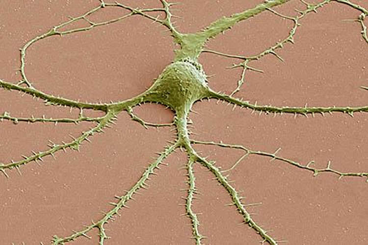 Image of a neuron.